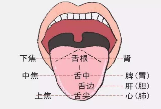 1,舌苔在舌两侧脱落——肝郁或肝火 肝随脾升,胆随胃降.