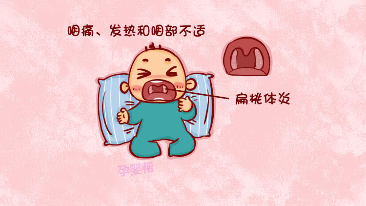 婴儿扁桃体发炎怎么办