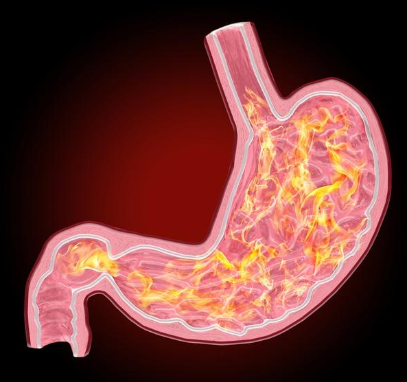 养胃专家：胃病老吃药不好，坚持吃恰玛古素食粉，每天都能强效护胃