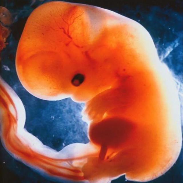 孕58天,有6mm胎芽没胎心,医生让考虑胚胎停育,要再等吗?