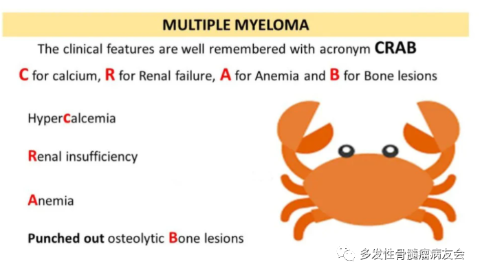 多发性骨髓瘤有哪些典型症状参考螃蟹症 史淑荣 主任医师 爱问健康