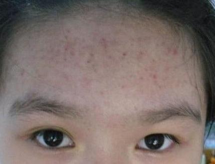 护肤保养开课啦_护肤保养教程_26岁干性皮肤女人如何保养护肤