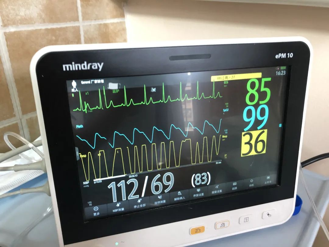 接受食道调搏术后阵发性室上性心动过速的她在县人民医院产下健康宝宝