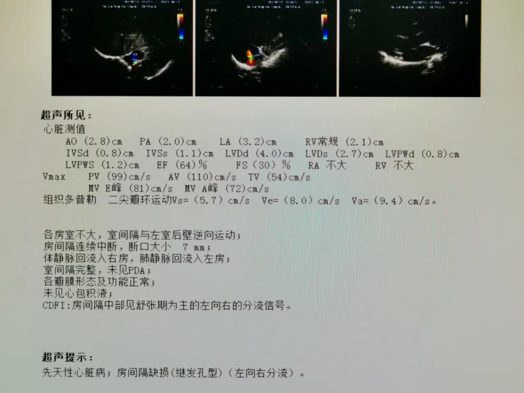 起搏器心脏彩超图片图片